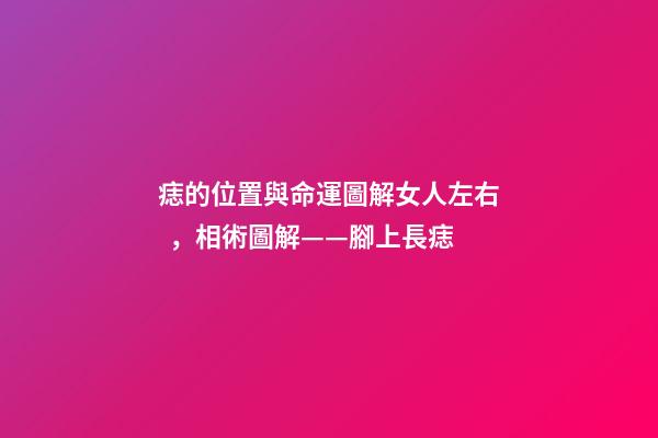 痣的位置與命運圖解女人左右，相術圖解——腳上長痣-第1張-觀點-玄機派